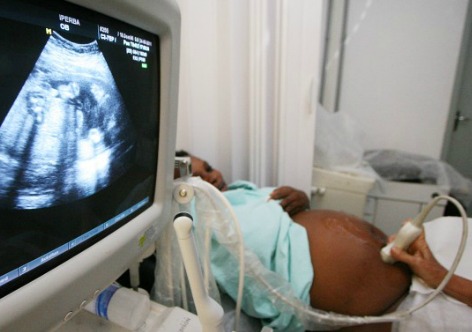 Com Bolsa Família gestantes iniciam o pré-natal mais cedo